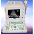 ultrasonographie machine à ultrasons et fabricant de matériel médical